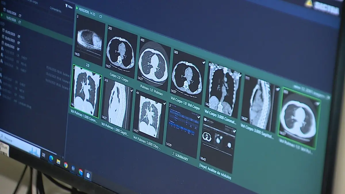 Hospital de Gaia Implementa Rastreio Inovador para Diagnóstico Precoce de Cancro do Pulmão